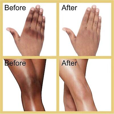 Body whitening