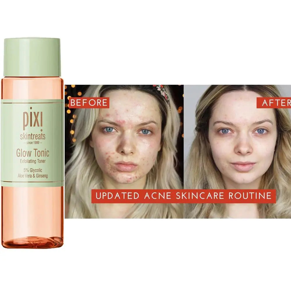 Pixi Skintreats حليبي تونيك جوهر شد شد البشرة المرطب مناسبة لمكياج الوجه الجاف والدهني العناية بالبشرة 100 مل