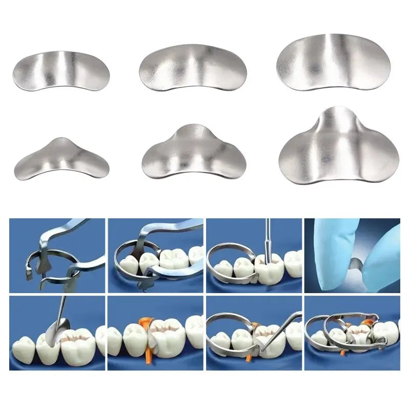 Denspay 100pcs/Box Dental Sectional Matrix System Dental Sectional Matrix Band Resin Clamping/Seperating Ring Dentist Tools