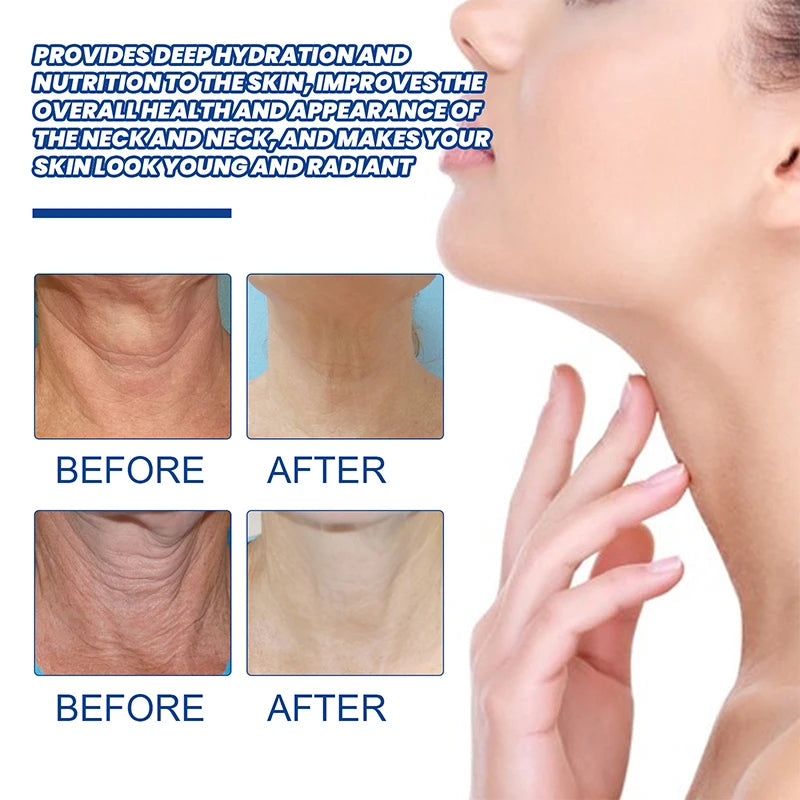 Neck Lines Protein Cream Moisturis Nourish Lift Neck Eliminate Double Chin Eliminate Neck Fine Lines Anti-ageing Rejuvenation