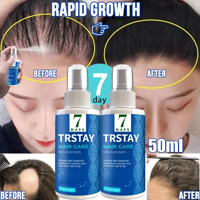 TRSTAY Hair Growth Spray Ginger Hair Grow Hair Essential Oil Treatment Preventing Hair Loss Spray Hair-restorer