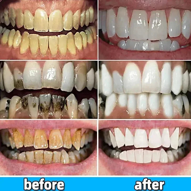 Whitening Teeth Toothpaste Dental Calculus Remover Plaque Remover Fresh Breath Brightening Preventing Periodontitis Dental Care