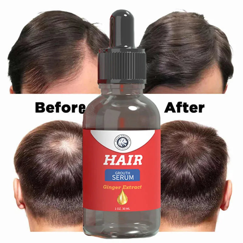 Hair Growth Products for Man Women Ginger Anti Hair Loss Fast Regrowth Hair Thicken Oils Scalp Treatment Beauty Hair Care Serum