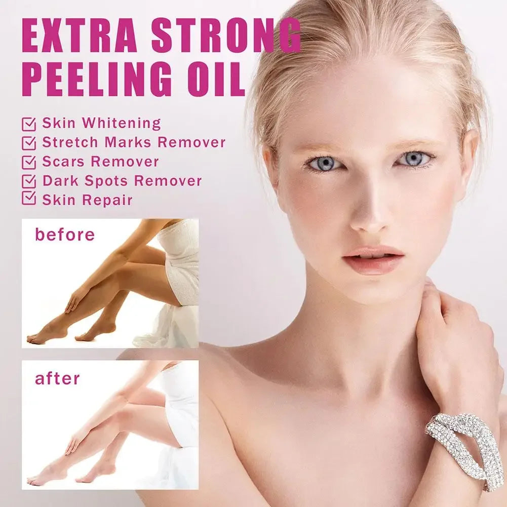 30/110ML Extra Strong Yellow Peeling Oil Whitening Lighten Elbows Knees Hands Even Skin Tone Whiten Skin Care