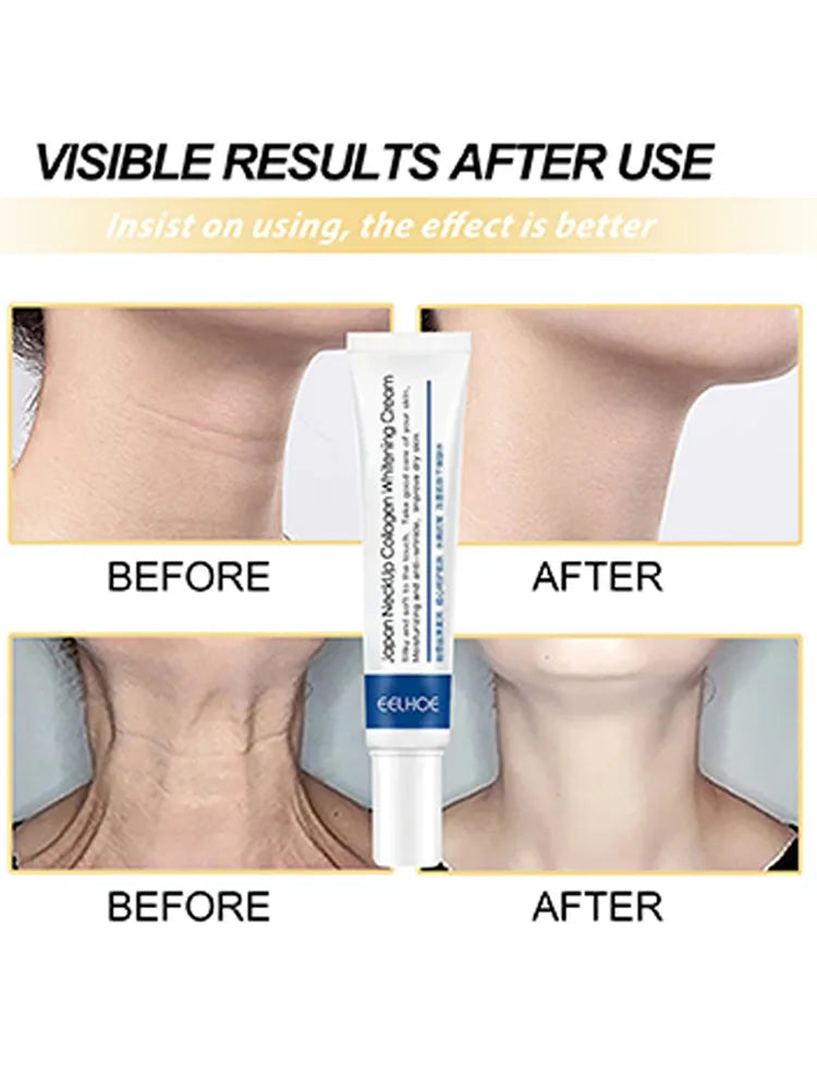 Neck Lines Protein Cream Moisturis Nourish Lift Neck Eliminate Double Chin Eliminate Neck Fine Lines Anti-ageing Rejuvenation