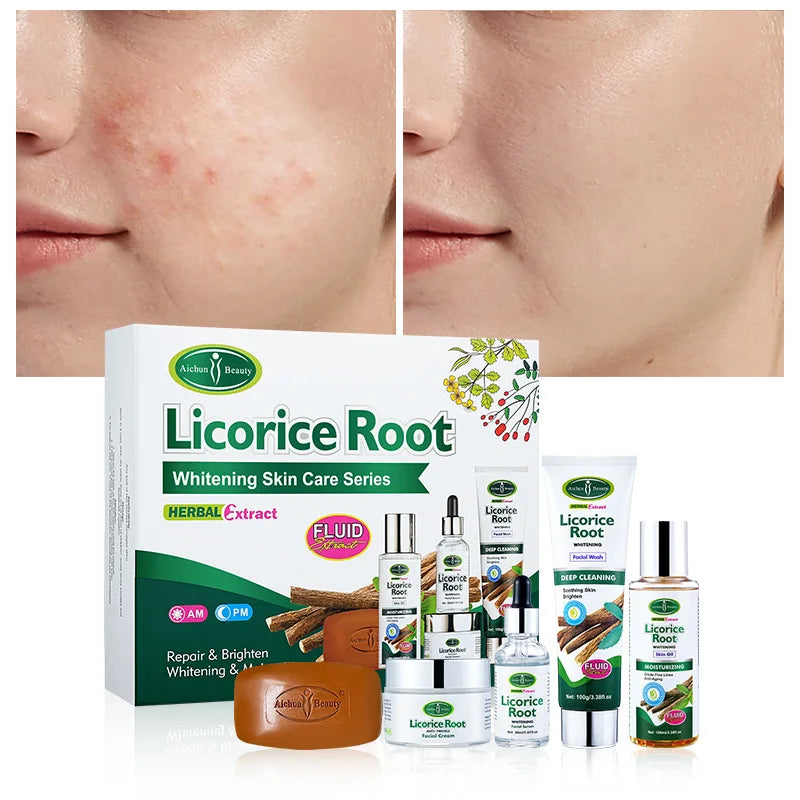 Disaar 5pcs Licorice Root Face Skincare Set Anti-freckle Whitening Serum Fade Acne Marks Moisturizing Soap Cream Essence Oil Kit