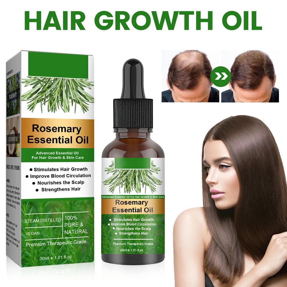 30ml Rosemary Essential Oil For Hair Rosemary Hair Faster Regrowth Oil Anti-frizz Hair Growth Anti Hair Loss Care Treatments