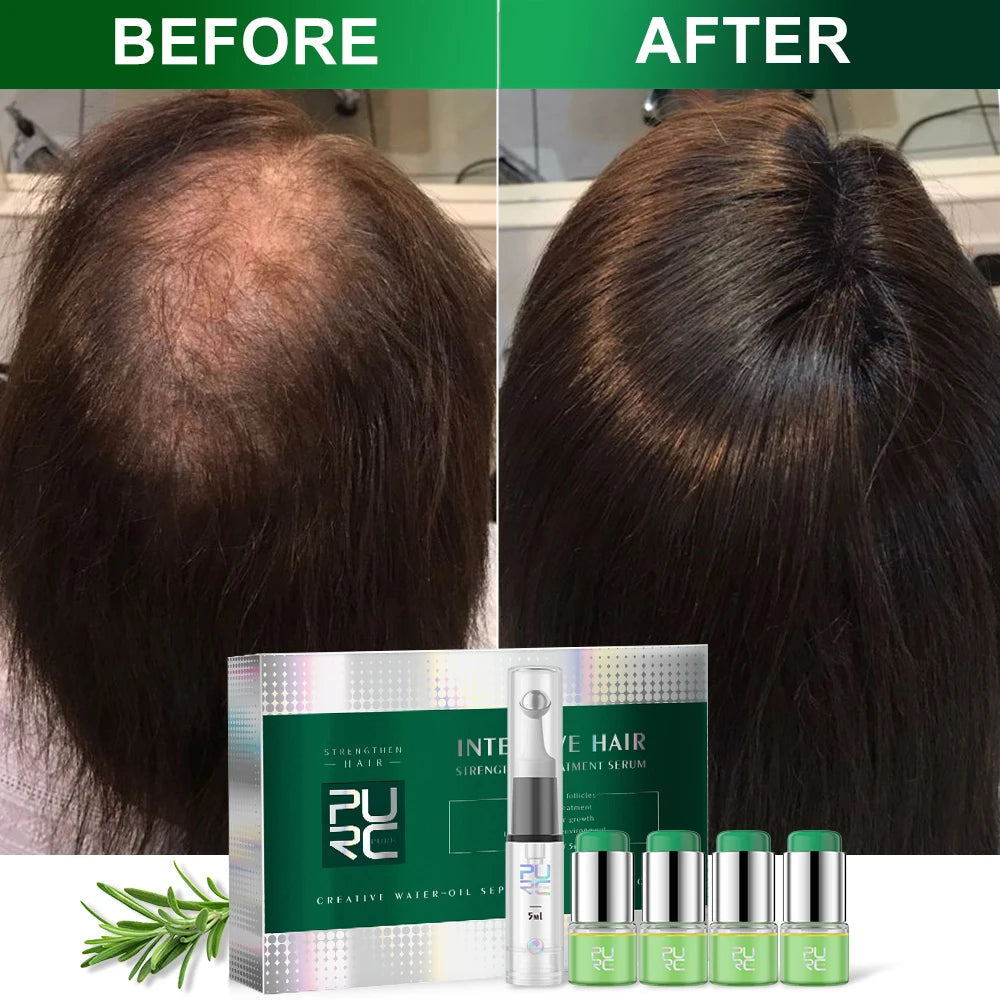 PURC Rosemary Oil Hair Growth Set Ginger Anti Hair Loss Scalp Treatment Oils Fast Hair Growth Products for Men Women