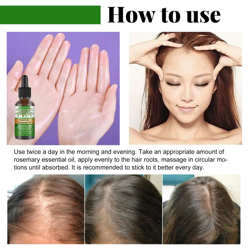 30ml Rosemary Essential Oil For Hair Rosemary Hair Faster Regrowth Oil Anti-frizz Hair Growth Anti Hair Loss Care Treatments