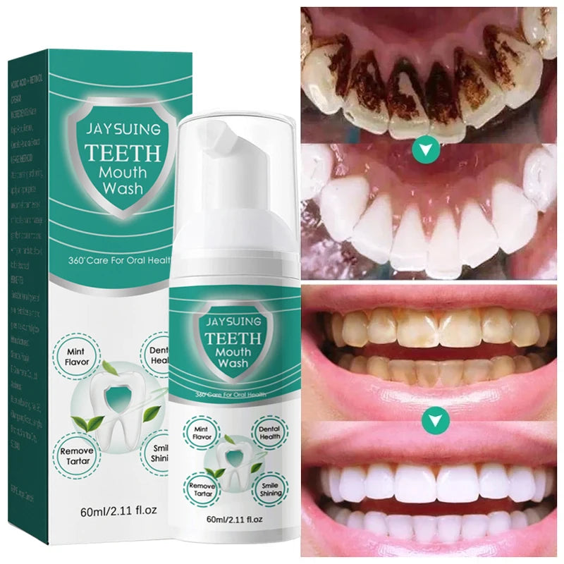 60ml Teeth Whitening Foam Toothpaste Tooth Deep Cleansing Mousse Remove Tartar Stain Reduce Yellowing Care For Gums Fresh Breath