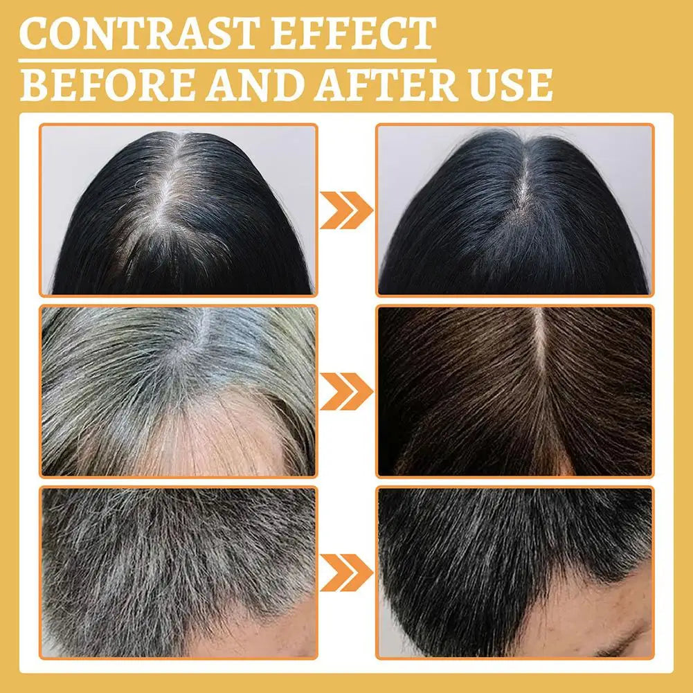 30ml Gray White Hair Treatment Serum Liquid White To Women Black Hair Loss Anti Product Men Nourish Color Natural Repair Ca Z4T8