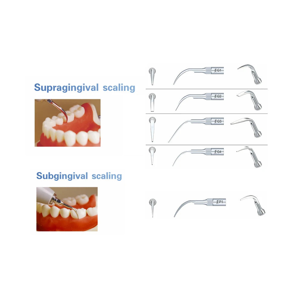 5 puntas de trabajo Wood-Pecker G1G2G3G4P1 para limpieza woodpecker dental  dental material