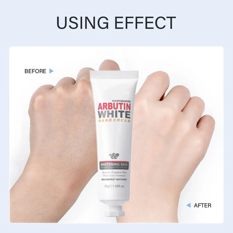 Niacinamide Arbutin Hand Cream Whitening Wrinkle Removal Anti-crack Moisturizing Fade Fine Lines Korea Skin Care Health Beauty