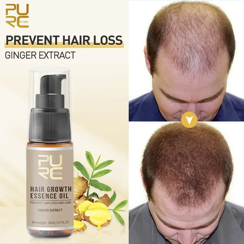 PURC Hair Growth Products Set Natural Ginger Essence Oil Fast Hair Growth Spray And Hair Thicken Shampoo Beauty Health 4Pcs