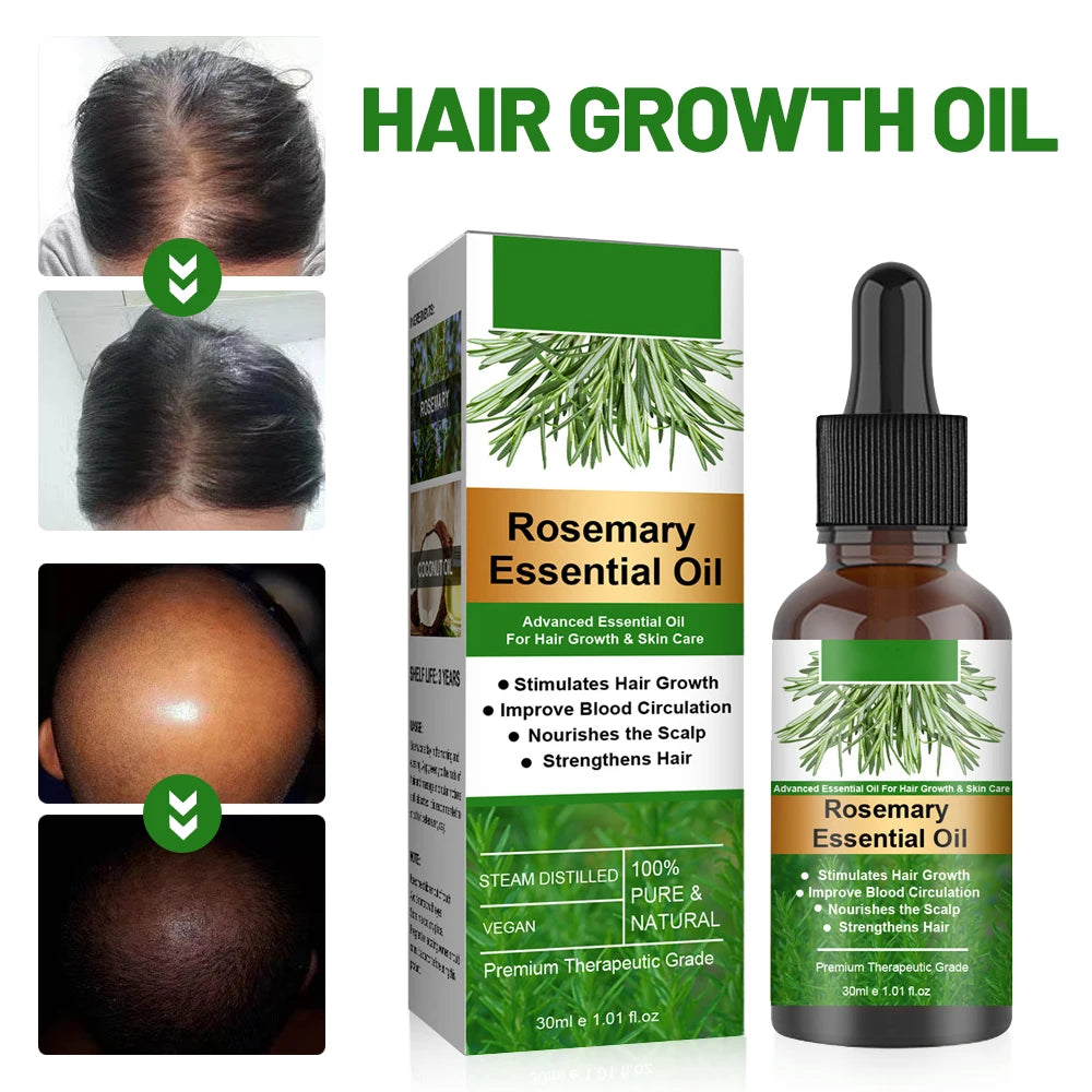 30ml Rosemary Essential Oil For Hair Rosemary Hair Faster Regrowth Oil Anti-frizz Hair Growth Anti Hair Loss Care Treatments