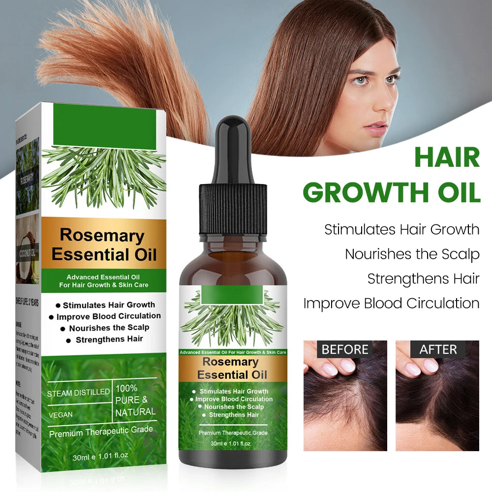 30ml Rosemary Essential Oil For Hair Rosemary Hair Faster Regrowth Oil Anti-frizz Hair Growth Anti Hair Loss Care Treatments