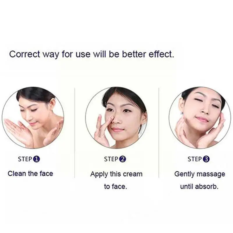 Face Cream Anti Acne Treatment Scar Acne Control Moisturizing Remover 30g Cream Acne Pores Whitening Cream Skin Care