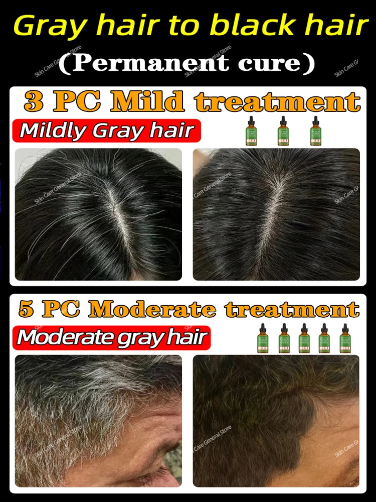 Anti Gray Hair Serum Remedy White Darkening Products