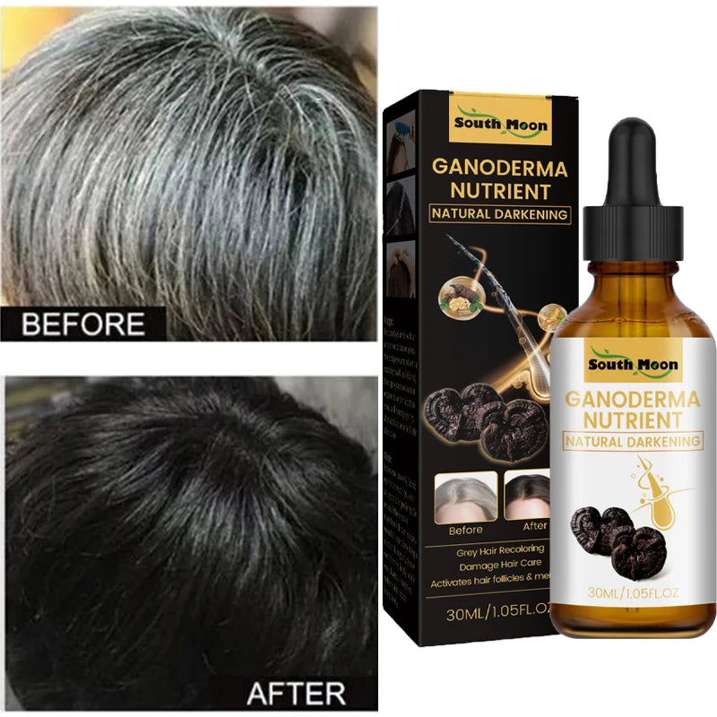 New Repair Damage Anti-Hair Sercum Gray Hair Care Serum Ebony Hair Nourishing Hair Loss Men And Women Fast Lasting Beauty Health