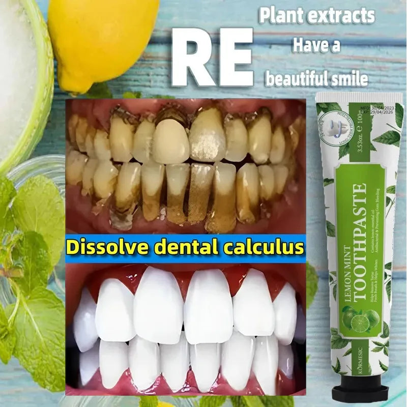 Lemon Mint Toothpaste Remover Dental Calculus Whitening Teeth Mouth Odor Removal Bad Breath Preventing Periodontitis Toothpaste