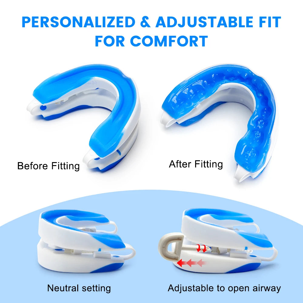 Adjustable Anti Snoring Mouth Guard Anti-Snoring Mouthpiece Sleeping Devices Bruxism Snoring Stopper Improve Sleep Mouthpiece