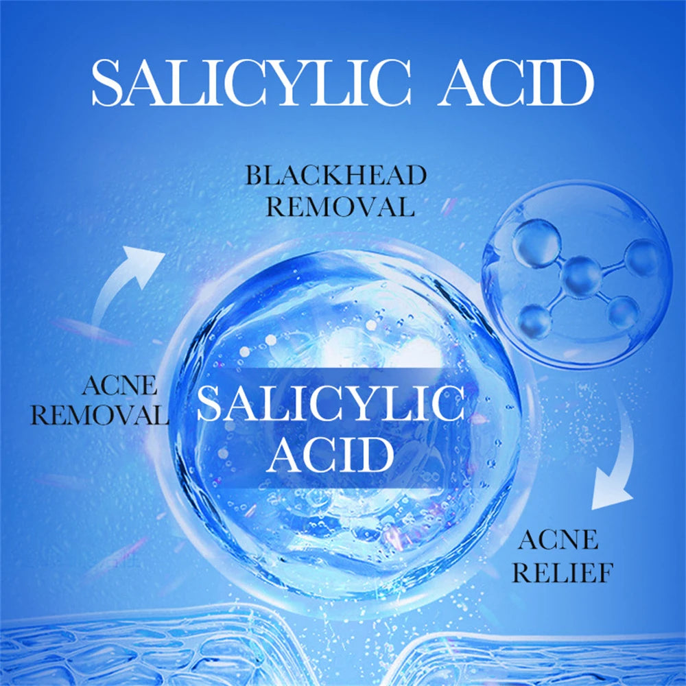 Salicylic Acid Acne Removal Cream