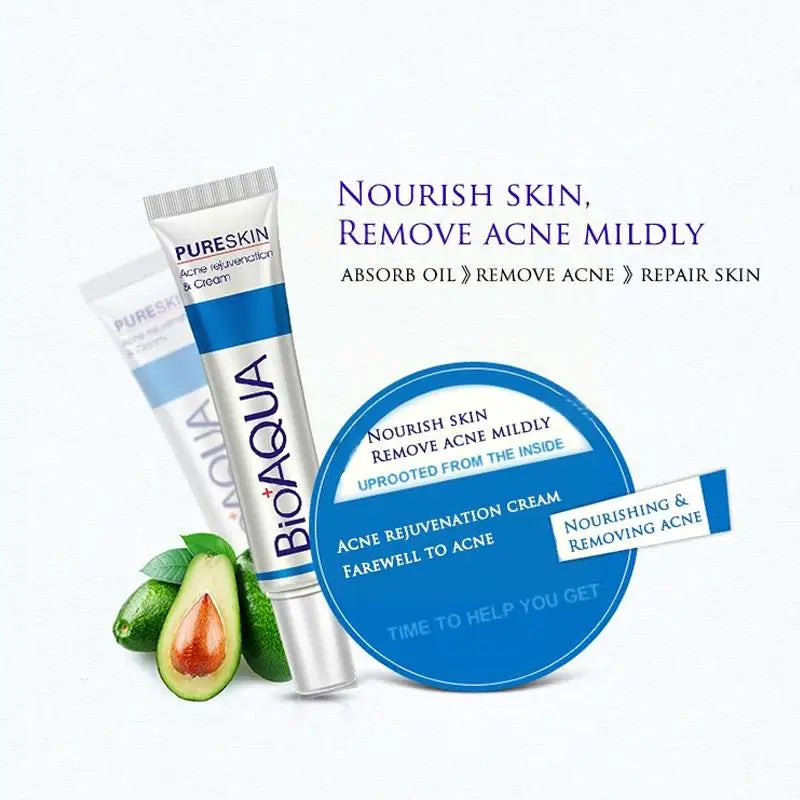 Face Cream Anti Acne Treatment Scar Acne Control Moisturizing Remover 30g Cream Acne Pores Whitening Cream Skin Care