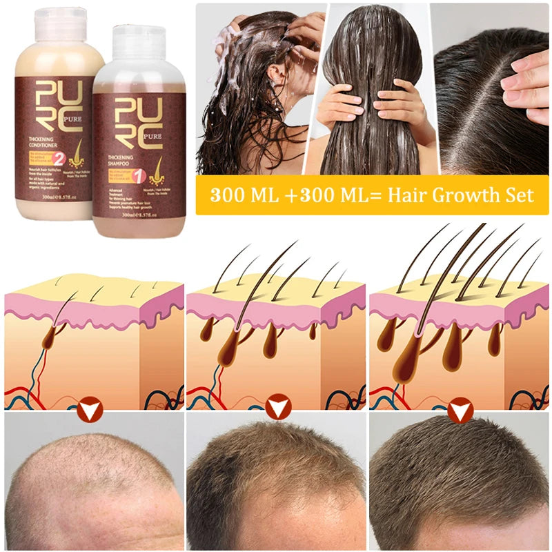 PURC Anti Hair Loss Shampoo Conditioner 100/300ML Ginger Hair Loss Treatment Fast Regrowth Products for Men Women Hair Care