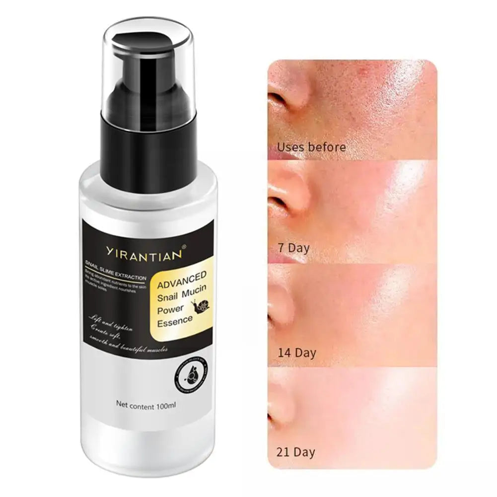 Snail 96 Skin Anti-aging Soothing Facial  Moisturizing