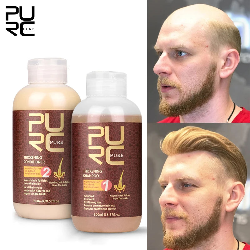 PURC Anti Hair Loss Shampoo Conditioner 100/300ML Ginger Hair Loss Treatment Fast Regrowth Products for Men Women Hair Care