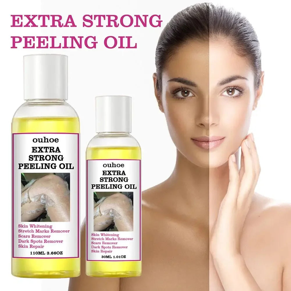 30/110ML Extra Strong Yellow Peeling Oil Whitening Lighten Elbows Knees Hands Even Skin Tone Whiten Skin Care