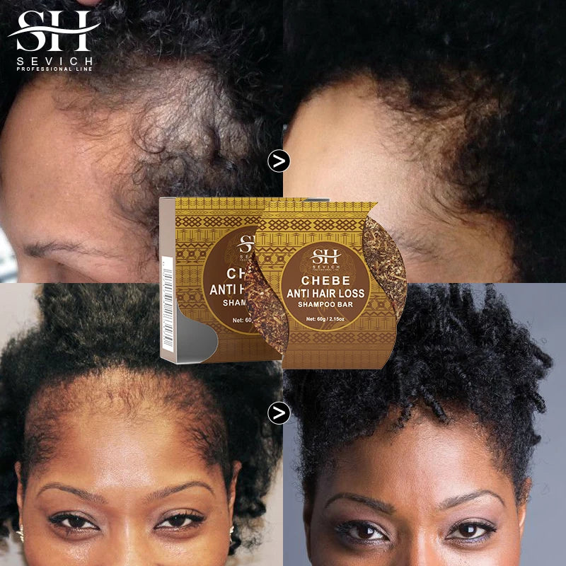 Fast Hair Growth Soap, Anti Hair Break and Hair Loss Treatment