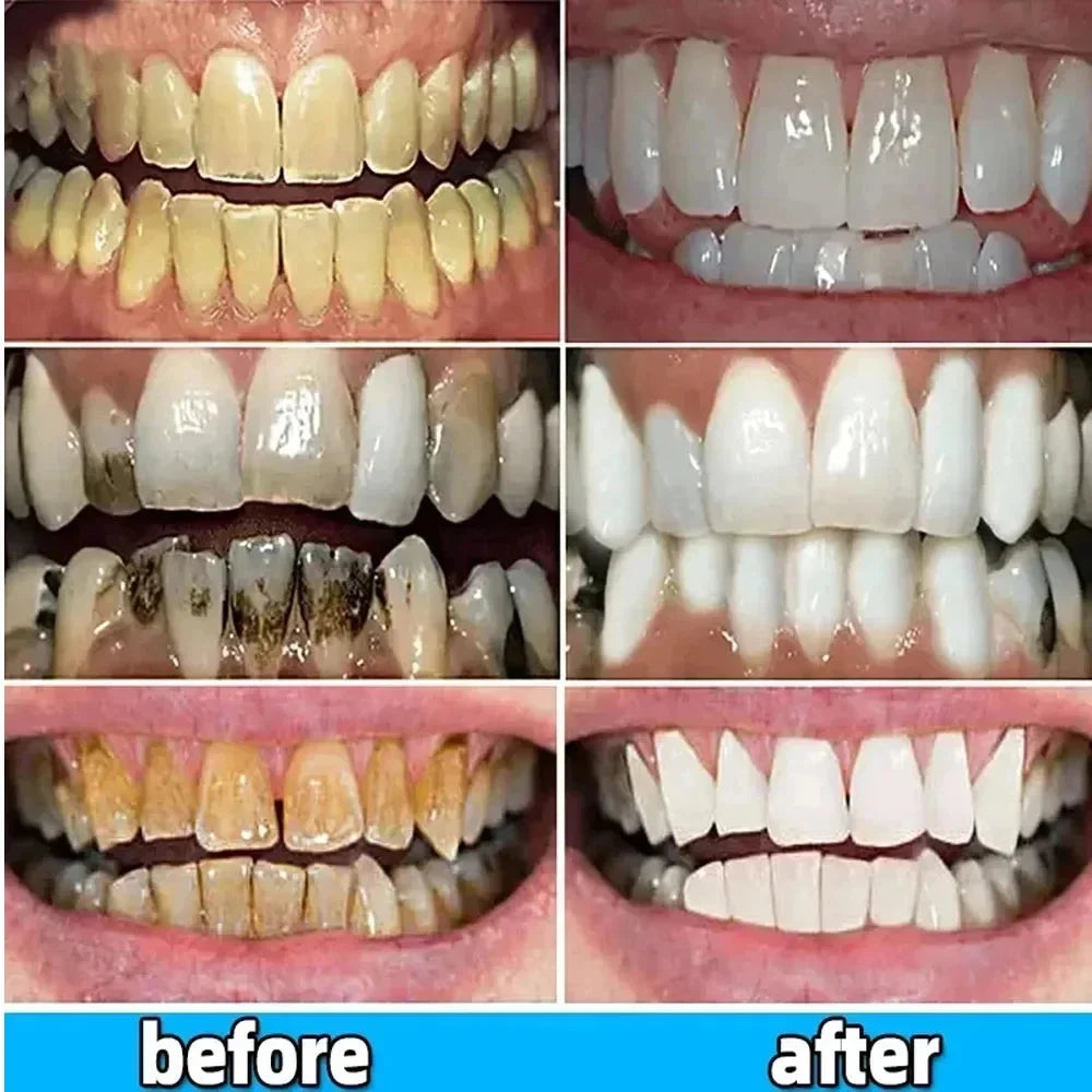 Whitening Teeth Toothpaste Dental Calculus Remover Plaque Remover Fresh Breath Brightening Preventing Periodontitis Dental Care