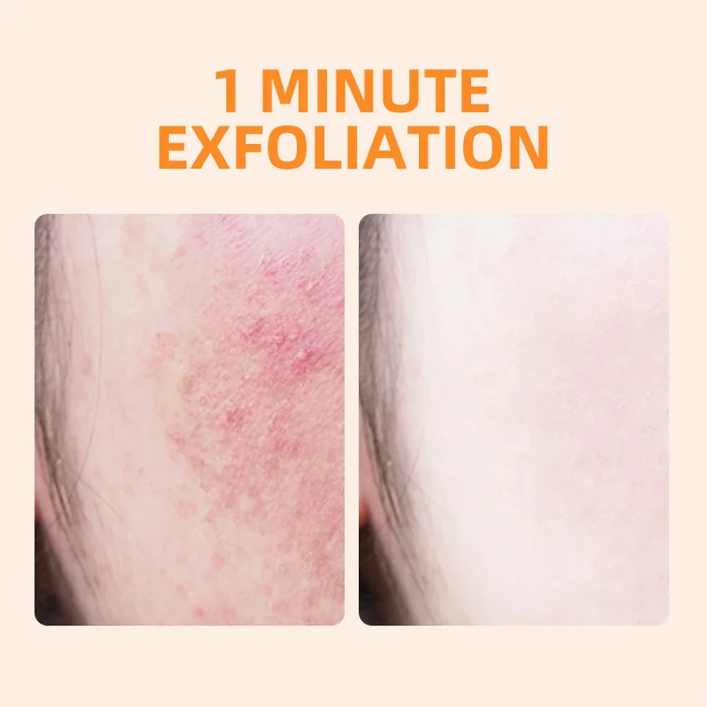 Orange Exfoliating Gel Dead Spot Remover Brighten Peeling 50g Gentle Repair Scrub Whiten Hydrating Moisturizer Korean Skin Care