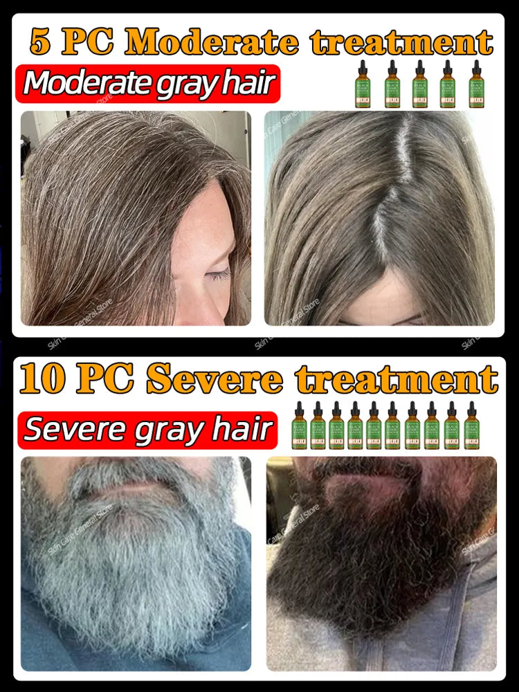 Anti Gray Hair Serum Remedy White Darkening Products