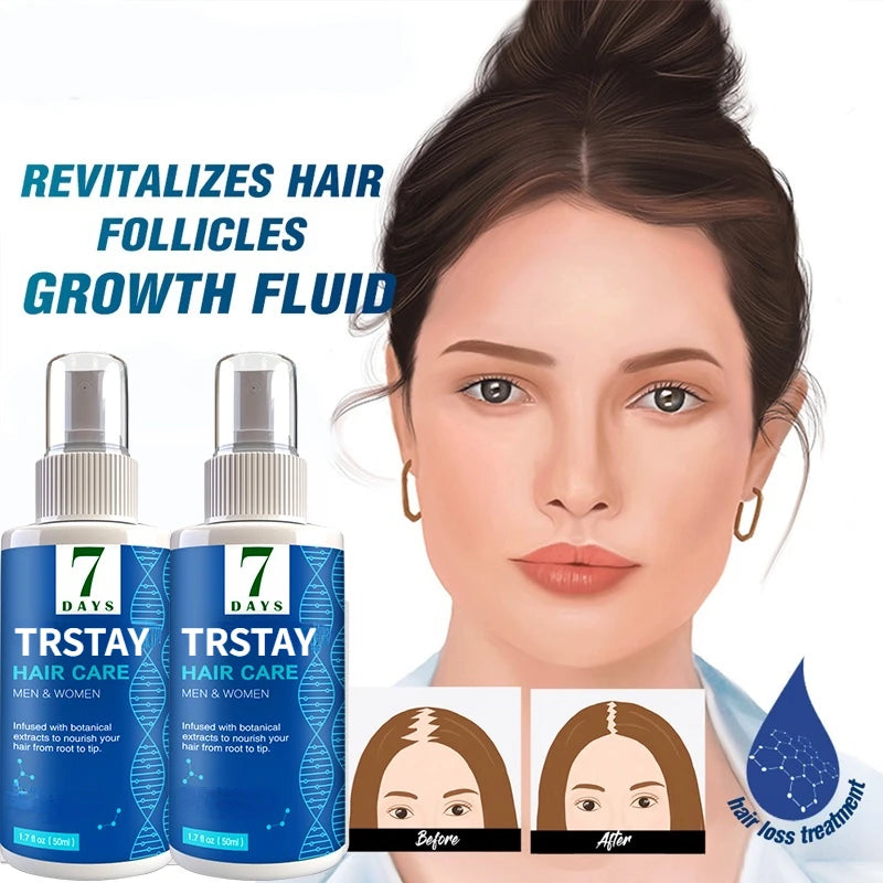 TRSTAY Hair Growth Spray Ginger Hair Grow Hair Essential Oil Treatment Preventing Hair Loss Spray Hair-restorer