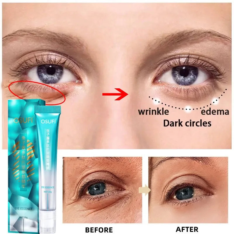 7 Days Anti-Wrinkle Eye Cream Get Rid Of Dark Circles Lighten Fine Lines Remove Eye Bags Puffiness Anti-Aging Serum Firming Eye