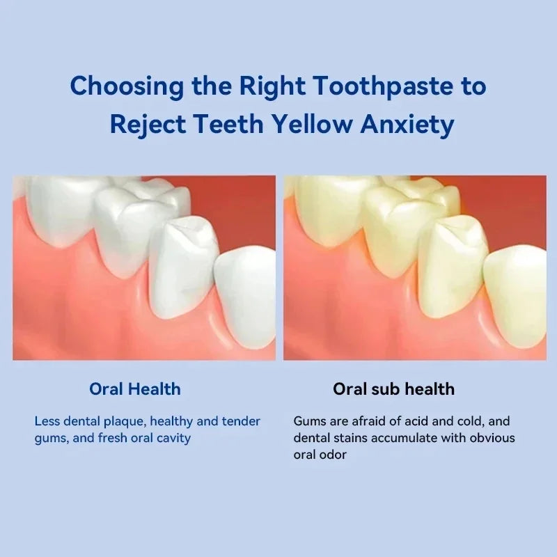 Whitening Teeth Toothpaste Dental Calculus Remover Plaque Remover Fresh Breath Brightening Preventing Periodontitis Dental Care