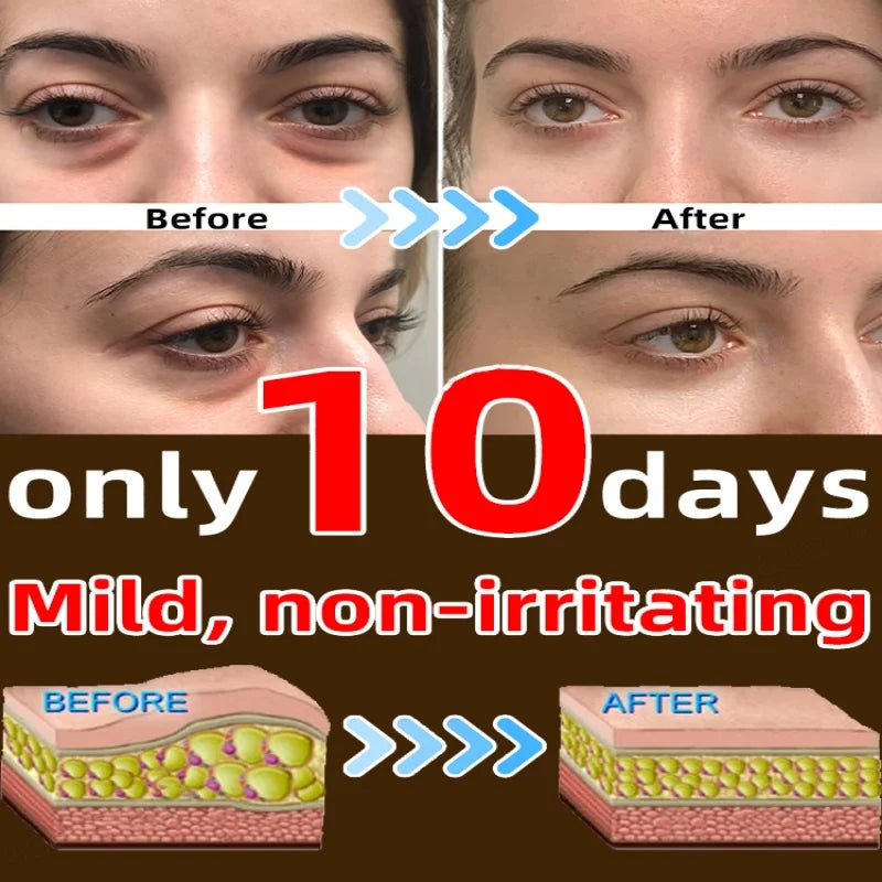 7 Days Anti-wrinkle Magic Eye Cream Remove Dark Circles Eye Bags Puffiness Lift Firm Smooth Skin Care Moisturizing Massage Serum