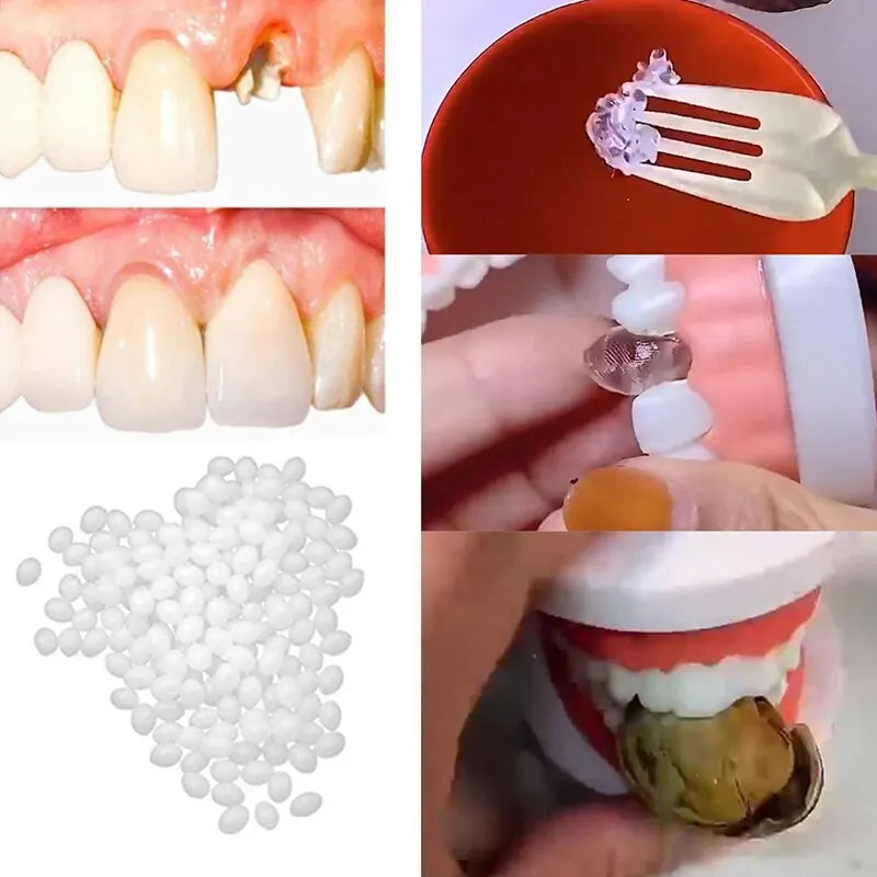 5g/10g/15g Dental Resin Shapeable Teeth Glue Makeup Dentures Modification Temporary Filling Teeth Repair Broken Teeth Tooth Gaps