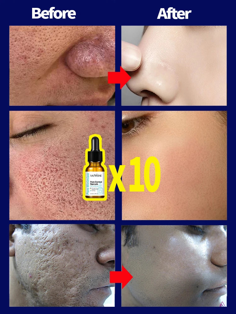 Pore Shrinking Serum Face Removing Large Pores Tightening Repairing Facial Pore Minimizing Essence Skin Care Beauty