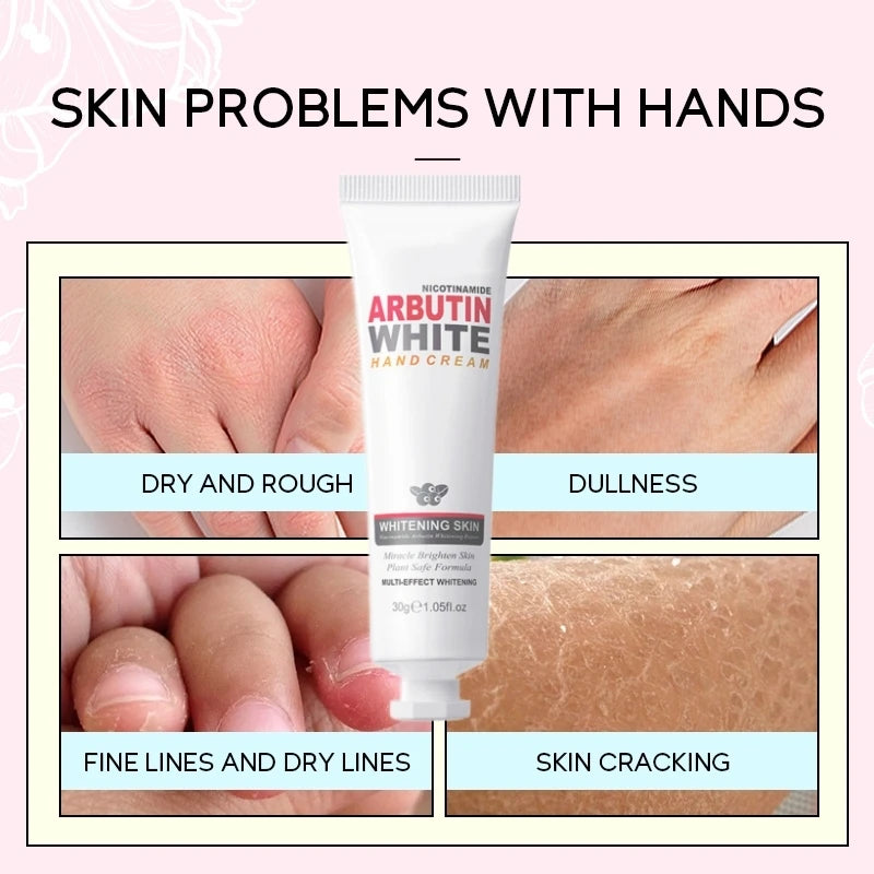 Niacinamide Arbutin Hand Cream Whitening Wrinkle Removal Anti-crack Moisturizing Fade Fine Lines Korea Skin Care Health Beauty