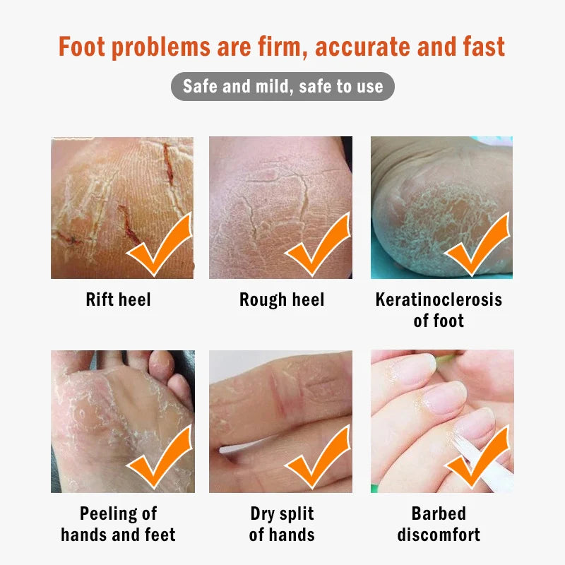 Vaseline Moisturizing Hand Foot Dead Skin Remover