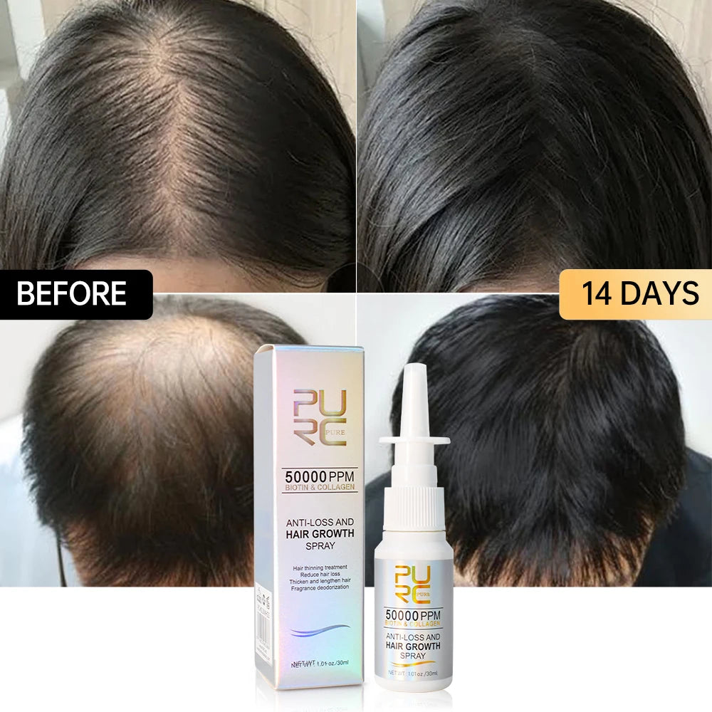 PURC Biotin Fast Hair Growth Products for Men Women Anti Hair Loss Serum Spray Scalp Treatment Thicken Regrowth Oil Hair Care