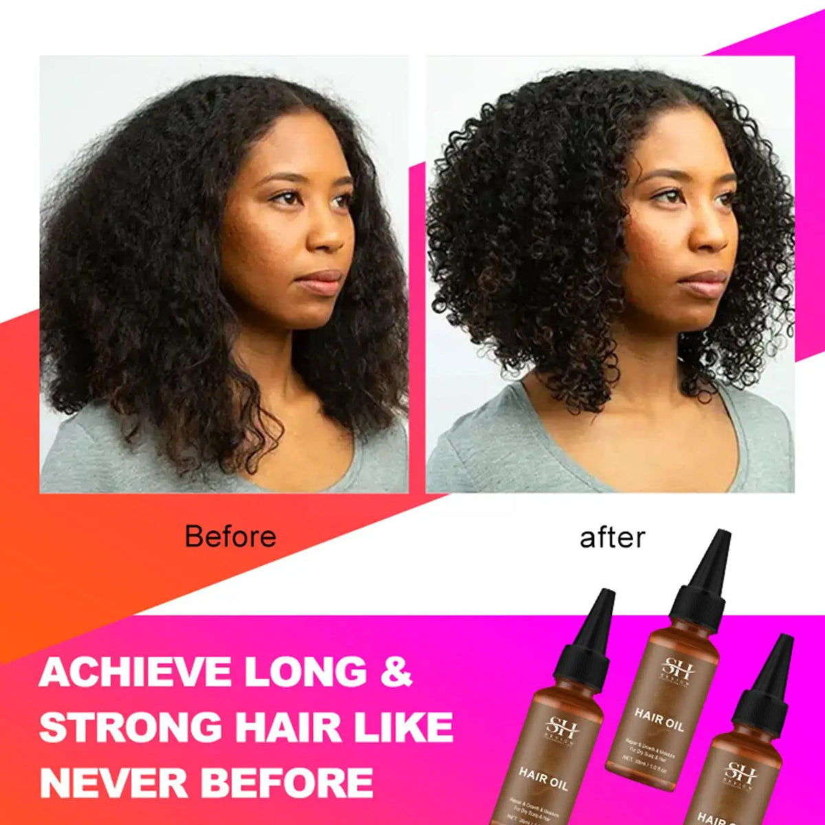 Hair Growing Oil Anti Hair Loss Treatment