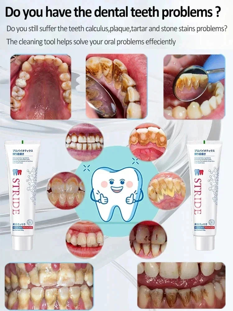 Whitening Teeth Toothpaste Dental Calculus Remover Plaque Remover Fresh Breath Brightening Preventing Periodontitis Dental Care