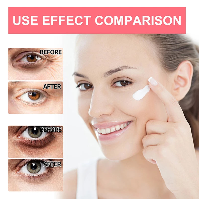 Retinol Anti Wrinkle Eye Cream Anti Aging Eye Bags Lifting FirmingRemove Dark Circles Whitening Moisturizing Brighten Skin Care