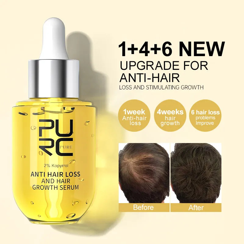 PURC Biotin Hair Growth Products for Men Hair Loss Treatment Serum Ginger Fast Hair Regrowth Hair Care