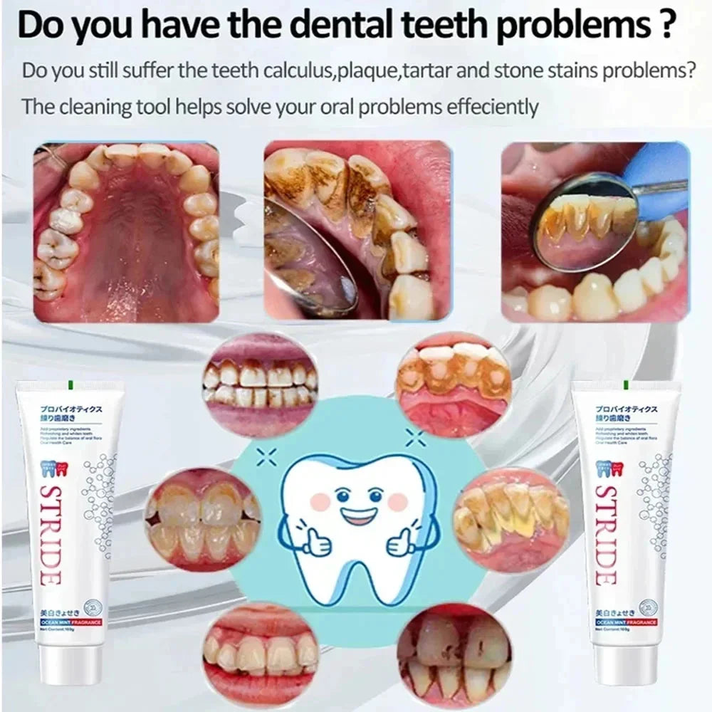 Whitening Teeth Toothpaste Dental Calculus Remover Plaque Remover Fresh Breath Brightening Preventing Periodontitis Dental Care