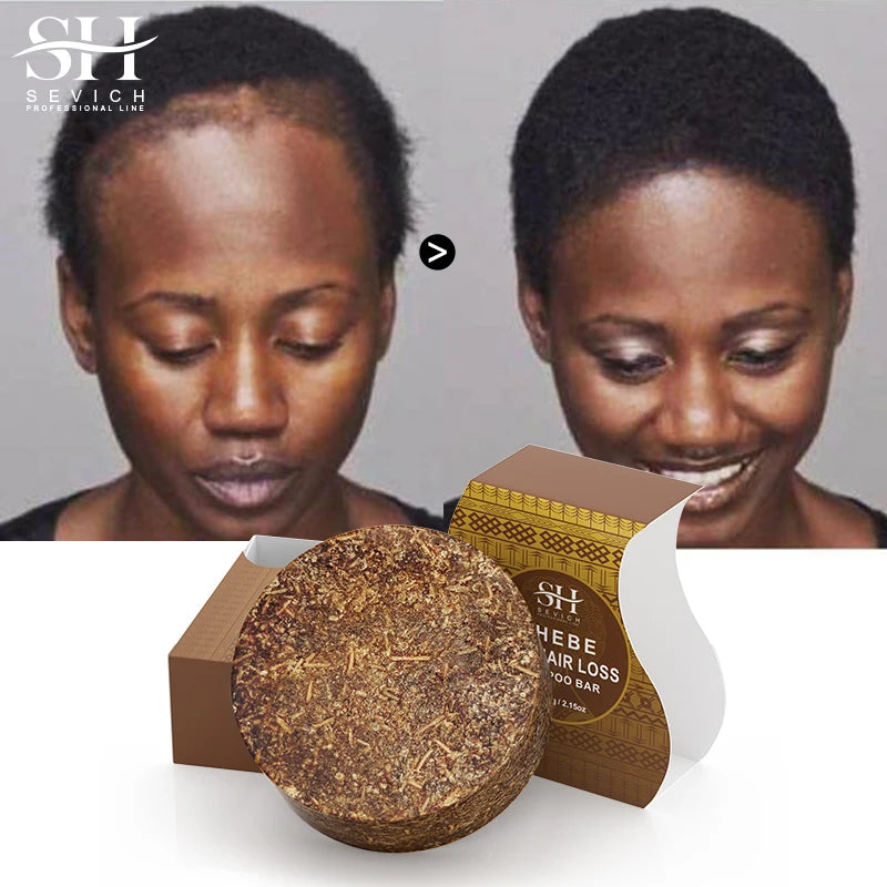 Fast Hair Growth Soap, Anti Hair Break and Hair Loss Treatment